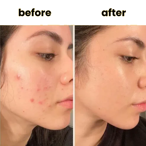 LUXVERA™ Turmeric Kojic Acid Pads (60 Pads)