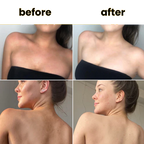 LUXVERA™ Turmeric Kojic Acid Pads (60 Pads)