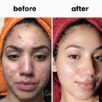 LUXVERA™ Turmeric Kojic Acid Pads (60 Pads)